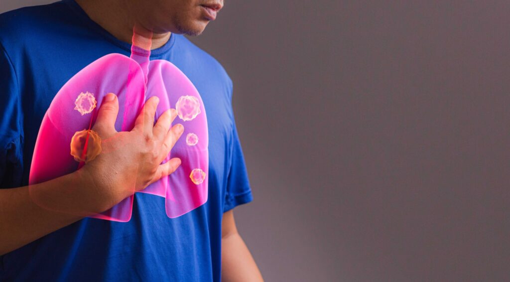 what causes fluid around the lungs