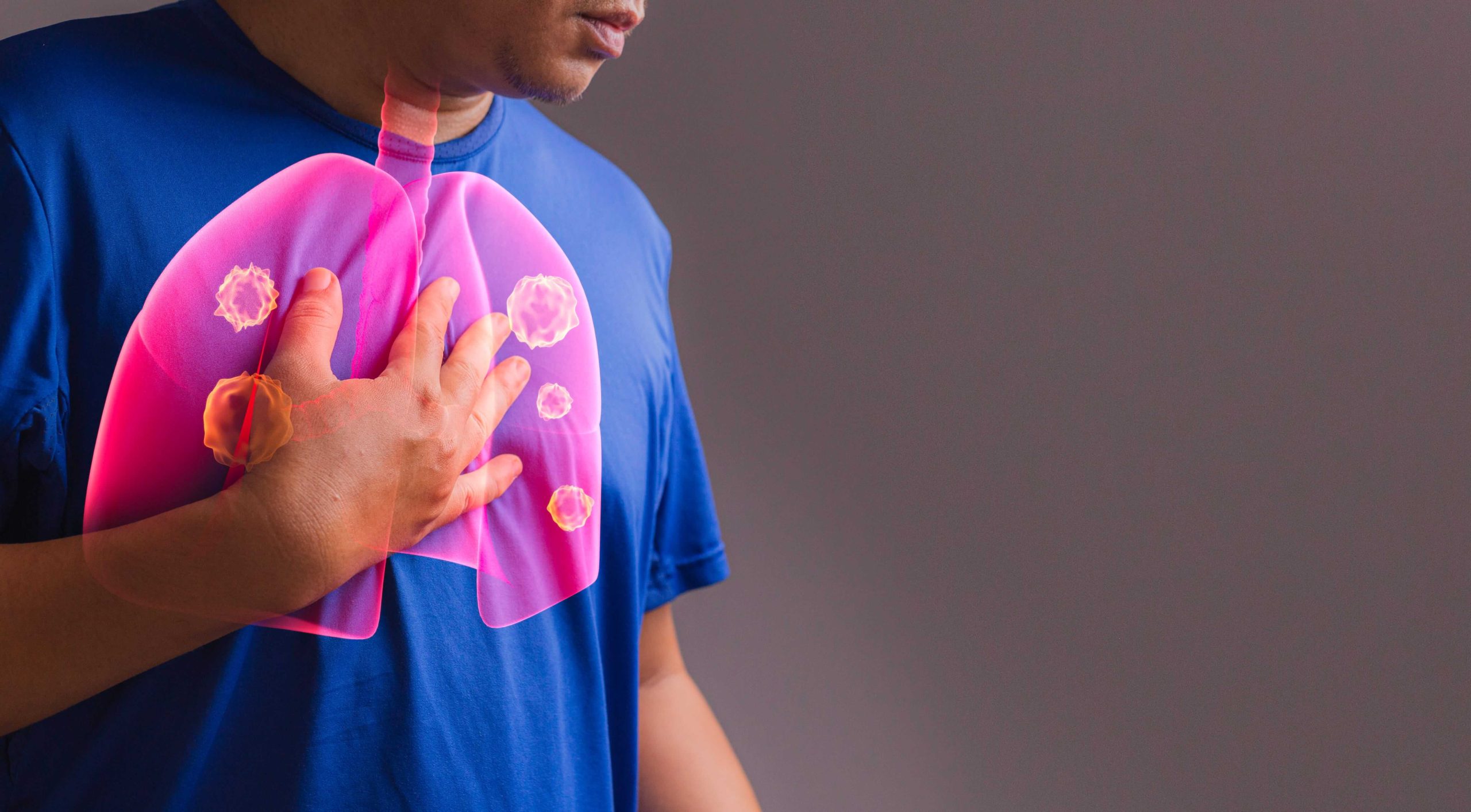 what causes fluid around the lungs